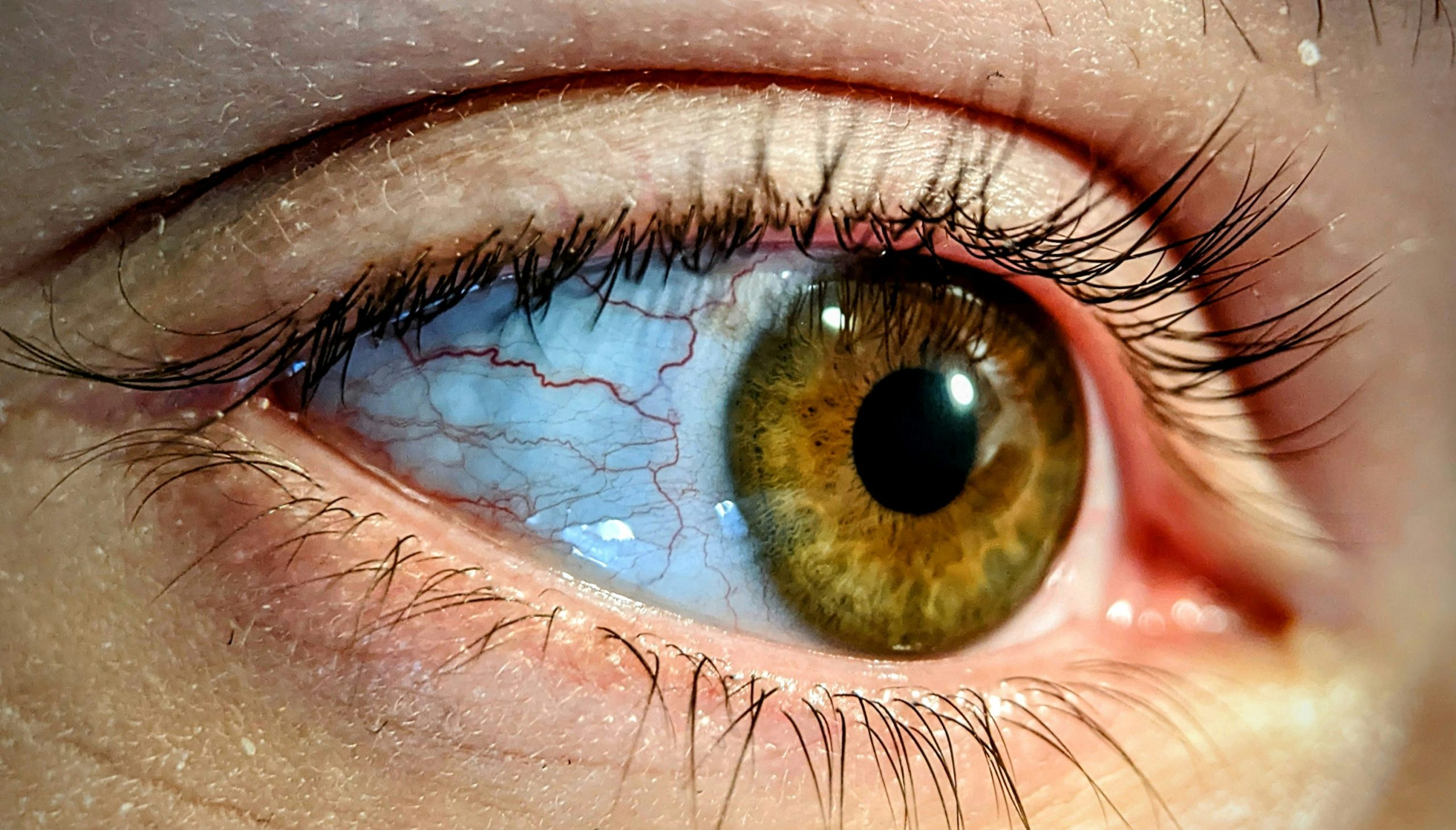 Tired-Looking Eyes: Causes and Effective Remedies for Brighter, Fresher Eyes